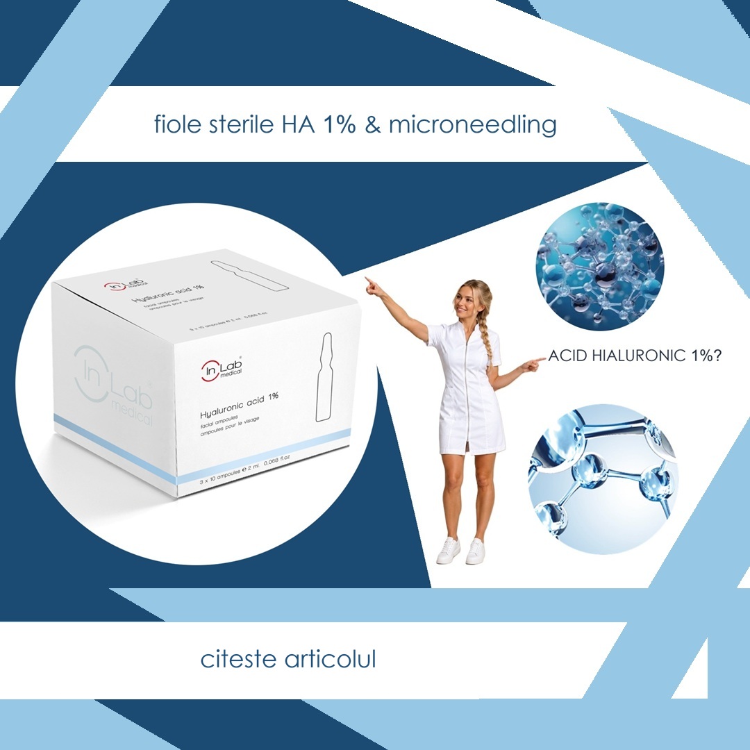 acid hialuroni fiole sterile 1%